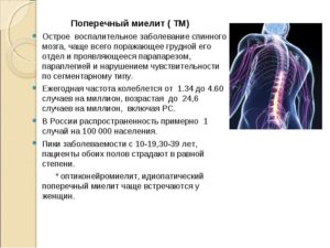 Поперечный миелит — виды, симптомы, методы лечения. Миелит — воспаление спинного мозга Поперечный миелит лечение