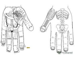 Иглотерапия суджук. Атлас точек на ладони по терапии суджок