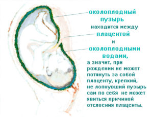 Как выглядит околоплодный пузырь? Плодный пузырь: интересные факты