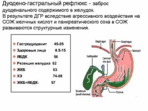 Эритематозная гастропатия дуодено гастральный рефлюкс. Гастродуоденальный рефлюкс