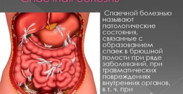 Гимнастика при спаечной болезни кишечника. Лечение кишечных спаек. Описание кишечной патологии.