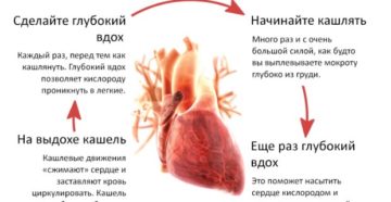 Колет сердце тяжело дышать ребенку. Давит в области сердца – что это может быть и почему происходит? Что делать в этом случае