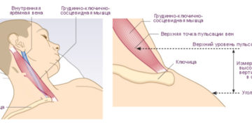 Яремная вена где находится у человека фото