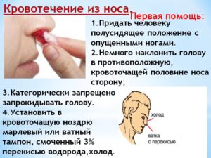 Как вызвать кровь из носа без боли? Что делать, если идет кровь из носа