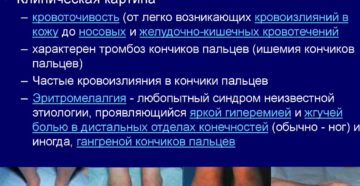 Исход эритремии. Анемическая стадия полицитемии. Симптомы анемической стадии