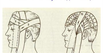 Медицинская повязка на голову как называется. Повязка чепец - техника наложения. Десмургия