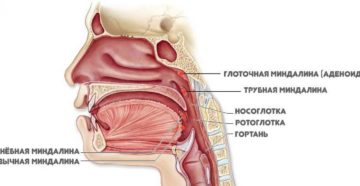 Гиперплазия язычной миндалины: симптомы, лечение, профилактика