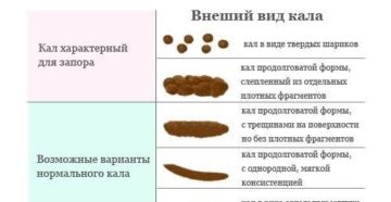 Почему кал черный при каких заболеваниях. Причины появления черного кала у взрослого