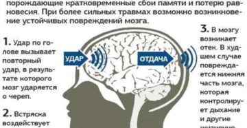 Как проверить есть ли сотрясение мозга. Как проверить сотрясение мозга