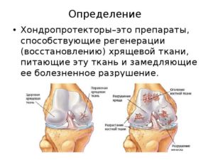 Стимулятор восстановления хрящевой ткани. Методы регенерации хрящевой ткани