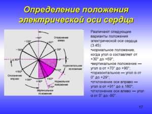 Пограничное отклонение эос влево во фронтальной плоскости. Показатели определения приведены ниже. С какой целью определяется ЭОС