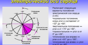 Пограничное отклонение эос влево во фронтальной плоскости. Показатели определения приведены ниже. С какой целью определяется ЭОС