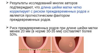 Почему шейка матки становится короткой во время беременности, чем опасно укорочение, как ее удлинить? Удлиненная шейка матки. Медитация для раскрытия шейки матки