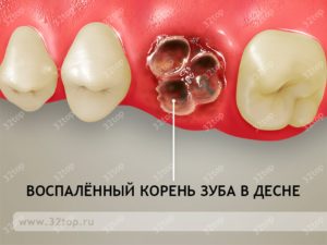 Корни нижних зубов фото