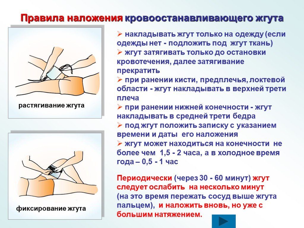 На какой срок может быть наложен кровоостанавливающий жгут. Правила наложения кровоостанавливающего жгута