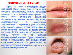 Липома большой половой губы. Как эффективно вылечить жировики на половых губах