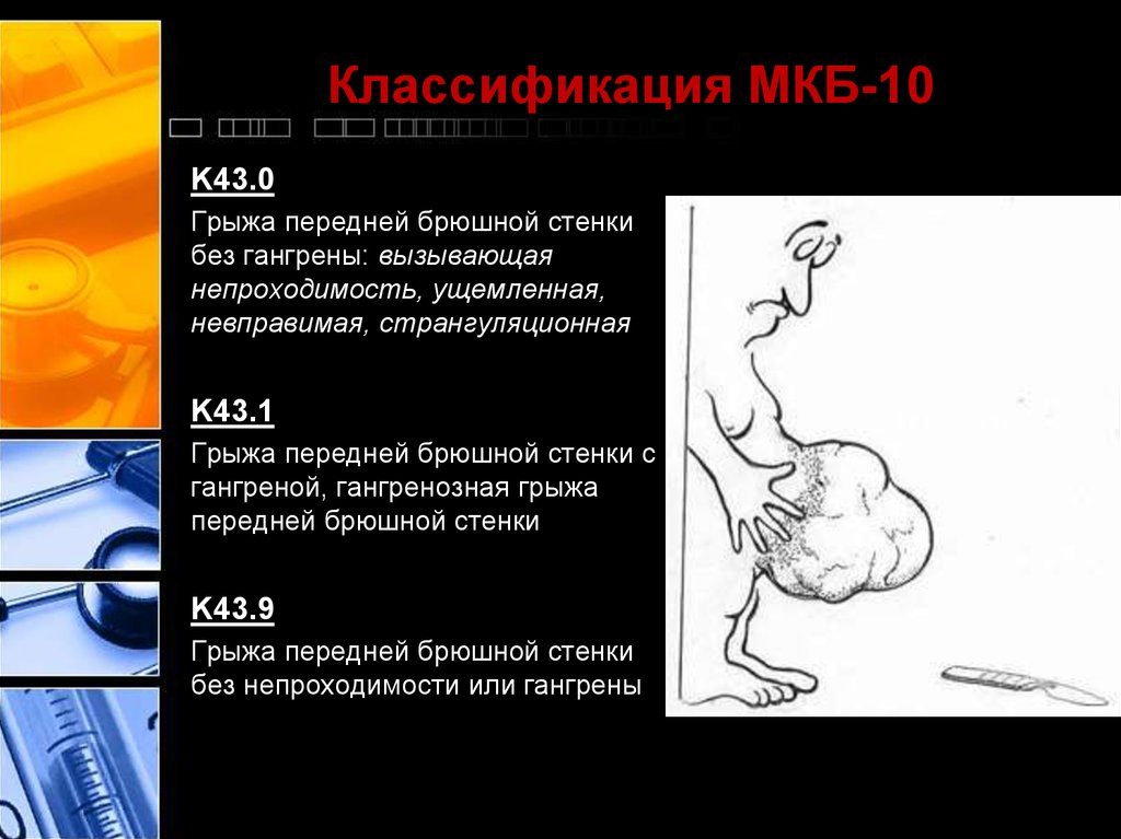 Ущемленная грыжа код по мкб 10