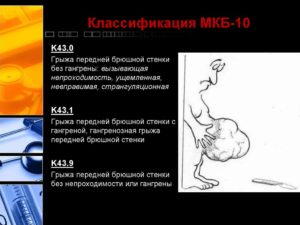 Ущемленная грыжа код по мкб 10