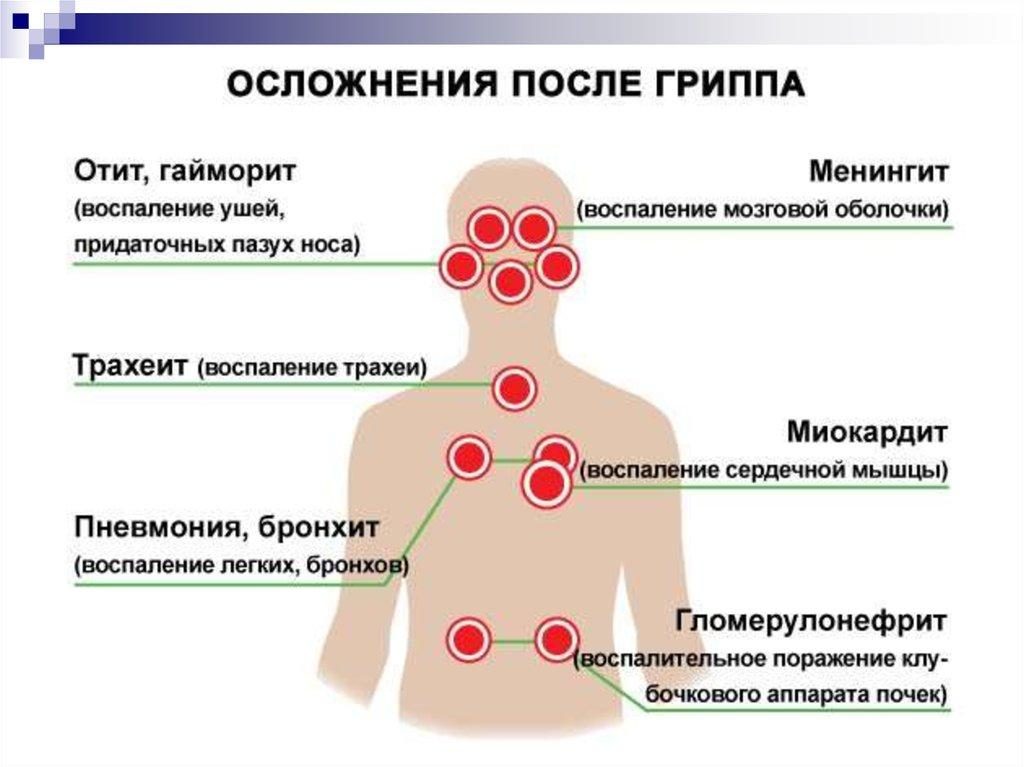 После орви низкое давление. Давление во время и после гриппа