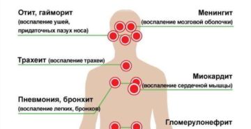 После орви низкое давление. Давление во время и после гриппа