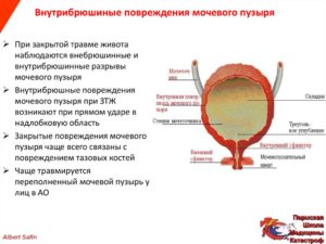 Разрыв мочевого пузыря: симптомы, лечение. Когда может лопнуть мочевой пузырь и какие последствия