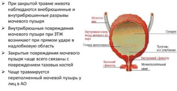 Разрыв мочевого пузыря: симптомы, лечение. Когда может лопнуть мочевой пузырь и какие последствия