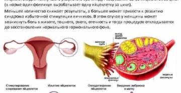 Бесплодие не приговор: как проводить стимуляцию овуляции народными средствами. Как простимулировать созревание и выход яйцеклетки народными способами