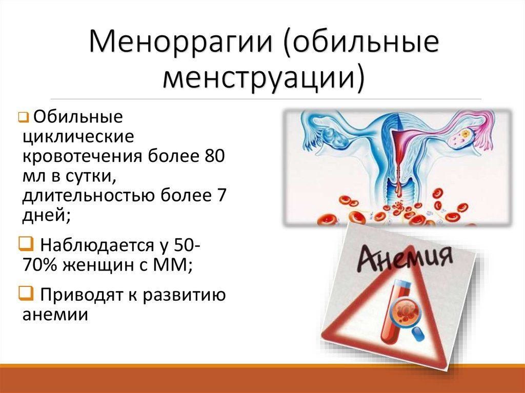 Почему появляется меноррагия у женщин и как ее лечить. Что такое меноррагия и как ее лечить