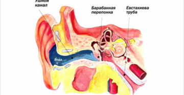 Попала вода в ухо болит что делать. Признаки воды во внутреннем ухе. Пытаемся убрать воду
