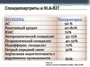 Анкилозирующий спондилит hla b27. HLA-B27 - что это? Выявление гена гистосовместимости